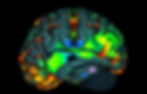 Eye-level view of a brain scan highlighting areas activated during mental maths