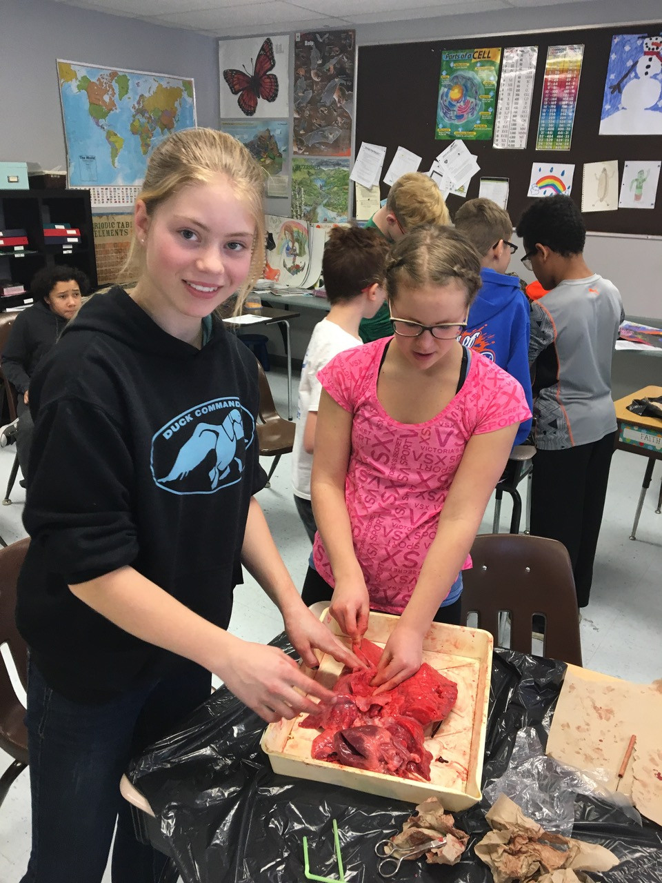 heart and lung dissection