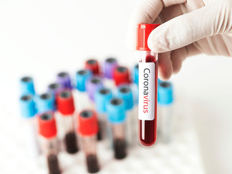 Estos son los laboratorios que está autorizados para realizar pruebas de Covid-19 en CostaRica