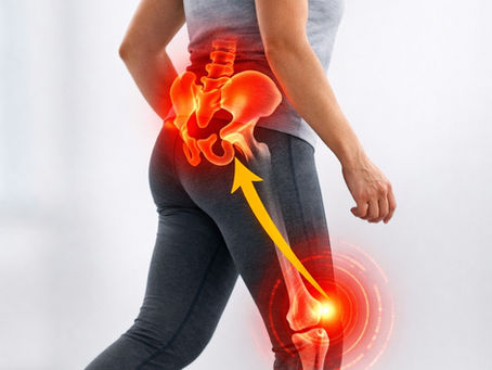 Dolore al ginocchio: quando la causa non è il ginocchio