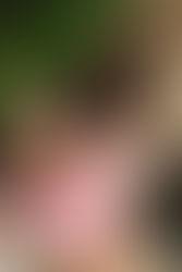 איך להתכונן לבדיקת העמסת סוכר בהריון?