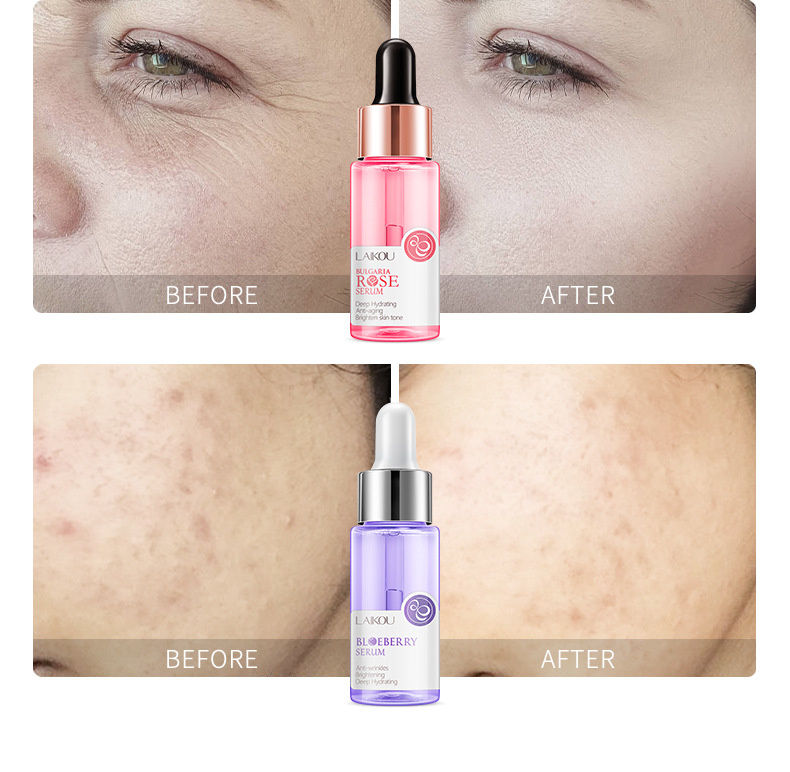 Thumbnail: EternaLuxe™ Serum Collection