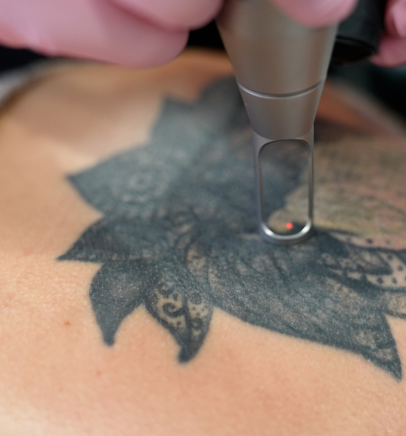 Eye-level view of a tattooed forearm resting beside a handheld laser device.
