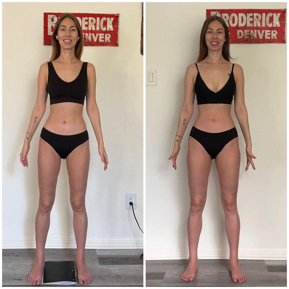 Lipedema doesn't go away. It becomes manageable.