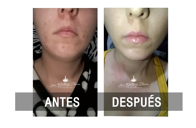 dermatologia en manizales4