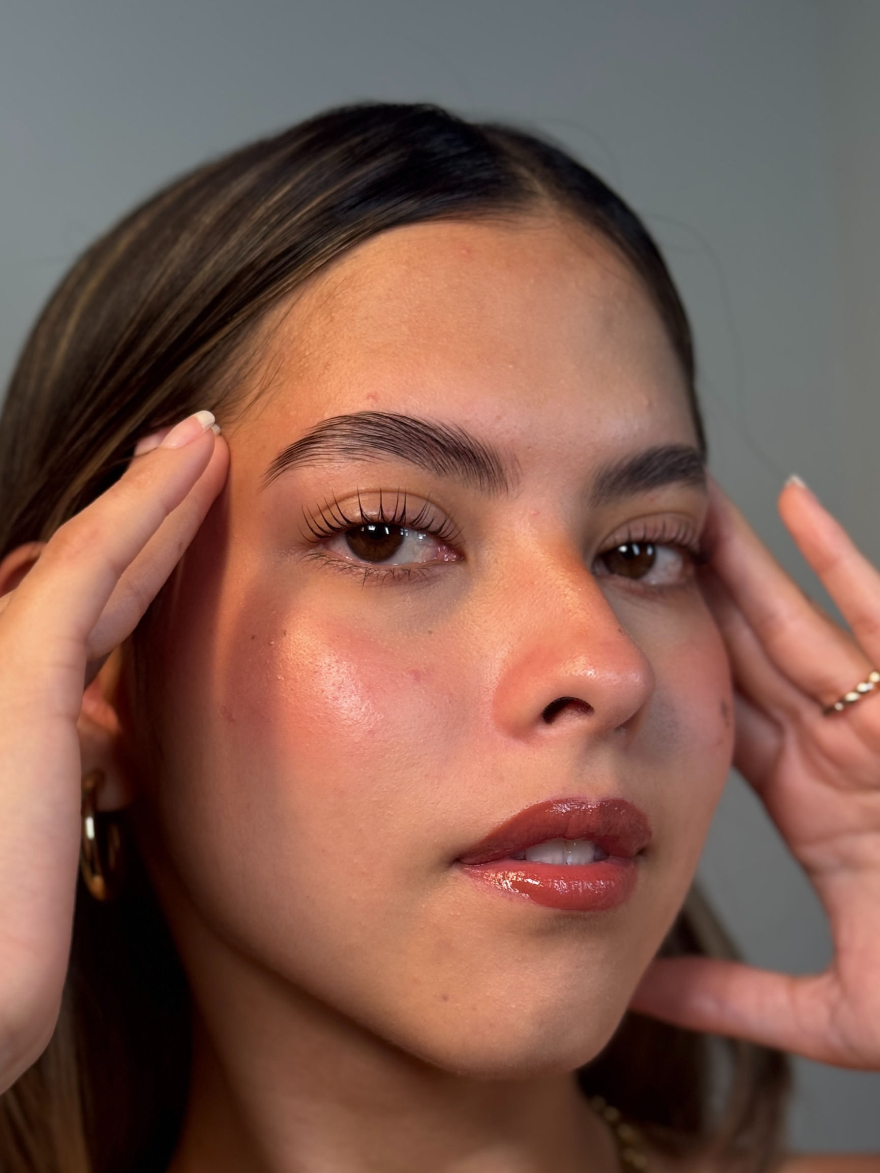 Reversión de lifting