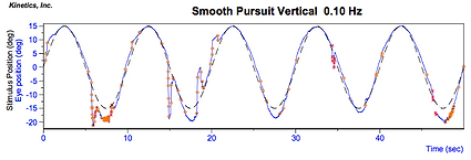 Eye movement therapy, vertical smooth pursuits