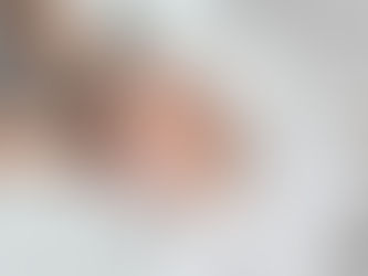 Headaches Canoga Park