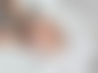 Headaches Canoga Park