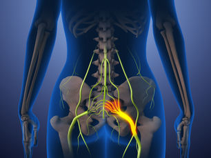 坐骨神経痛の本当の原因と対処法｜繰り返す痛みを根本から改善したい方へ