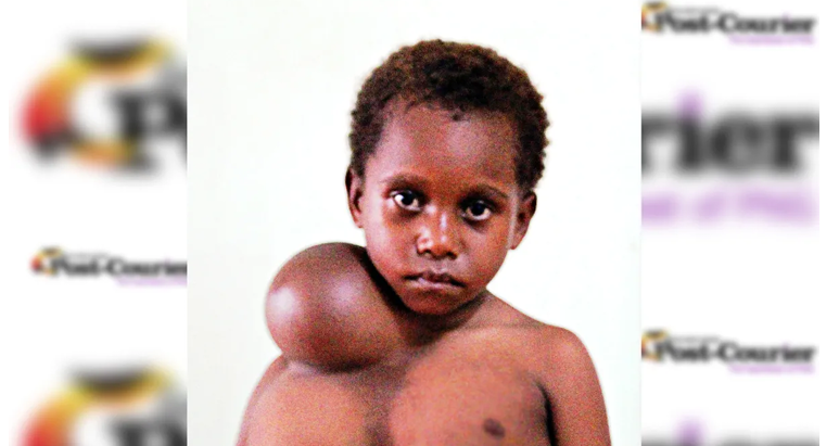 HELP FOR LITTLE YAOM AT LAST