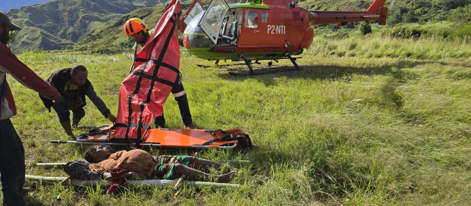 Retained twin from Sarawaget delivered safely after Medevac