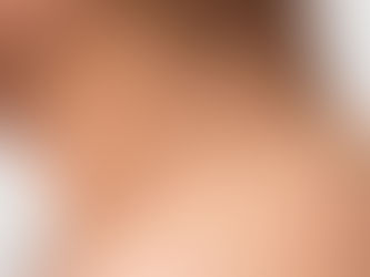 טיפול בסרחי עור