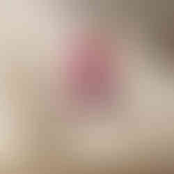 Close-up pop art illustration of glossy pink lips on a pale face.