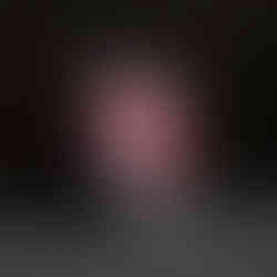 Close-up art print of glossy pink lips with a lighter flame reflecting on the surface.