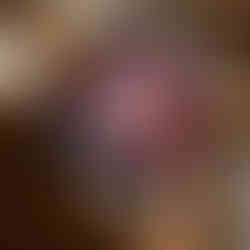 Close-up art print of glossy pink lips with a lighter flame reflecting on the surface.