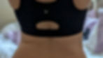 Picture of real client's back and waist before CryoSculpt services