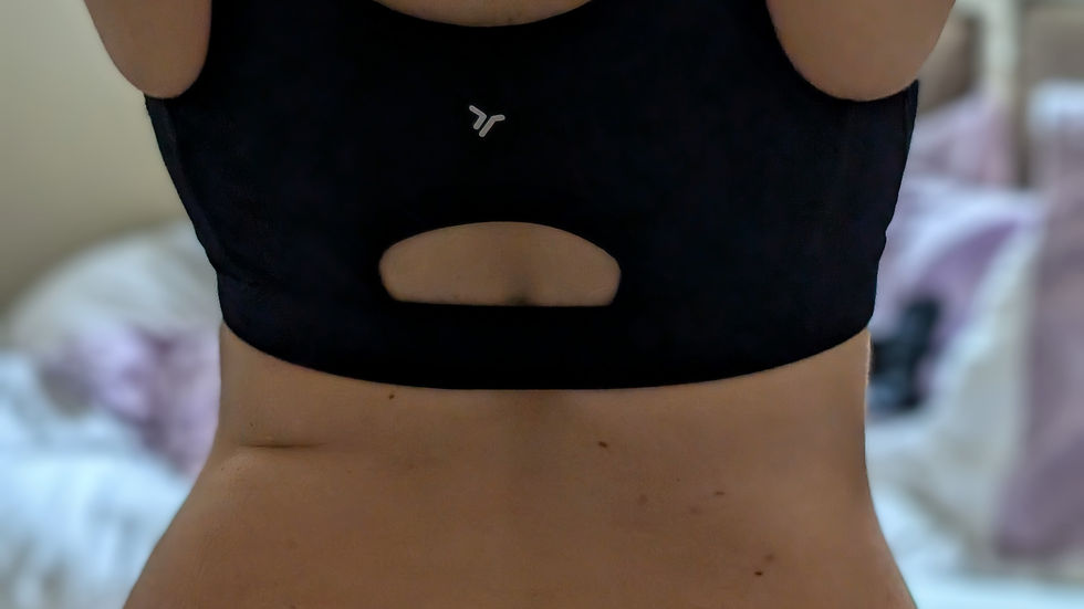 Picture of real client's back and waist before CryoSculpt services