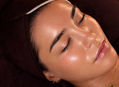 Glass skin results - Wellness Lounge PDRN skincare treatment Chiswick London