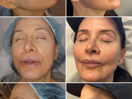 Best Skin Care for Aging Skin