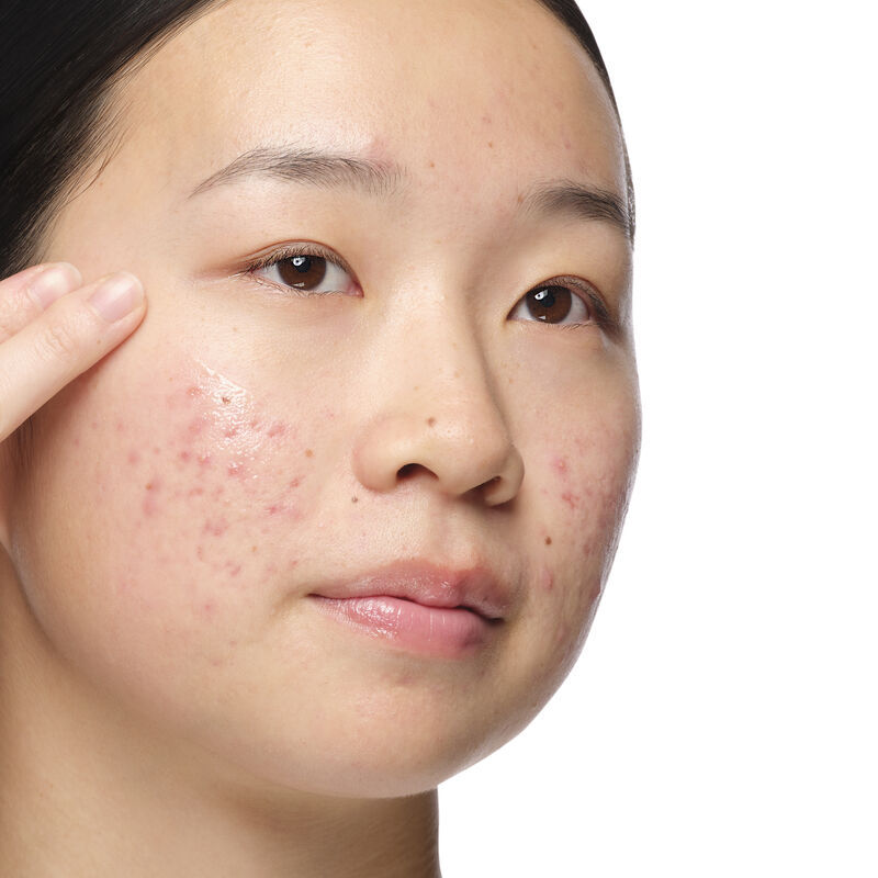 الصورة المصغرة: The Ordinary Aloe 2% + NAG 2% Solution 30ml