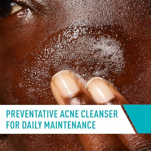 CeraVe Acne Control Cleanser preventative acne cleanser for daily maintenance closeup skin pores