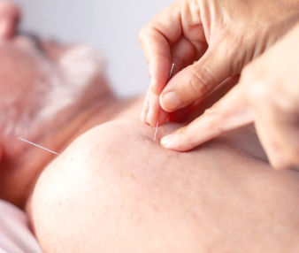 Acupuncture for insomnia