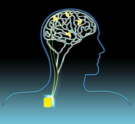 What is deep brain stimulation?