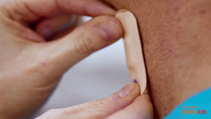 Rémission à la suite d’un AVC : des capteurs électroniques à fleur de peau