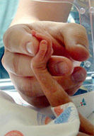 Premature and low birth weight babies