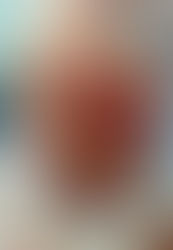 Premature and low birth weight babies