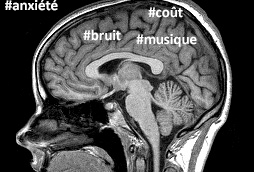 Anxiété face à l’IRM : Twitter aiderait les professionnels à mieux comprendre les patients