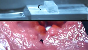 Bientôt, un mini « robot-chenille » dans notre corps ?