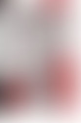 Dance as Complementary Therapy for Parkinson Disease