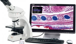 Une technologie de 1886 pour mieux comprendre les maladies intestinales