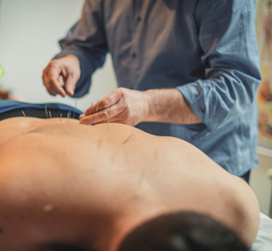 What to Expect From Acupuncture Care Over Time