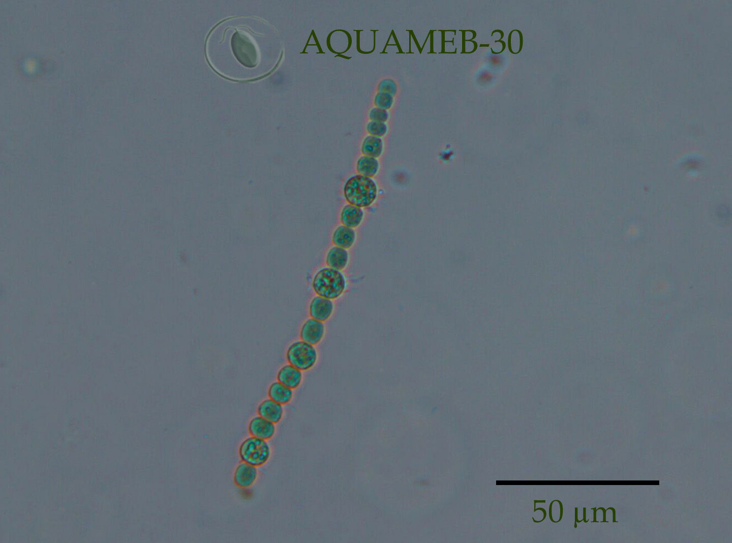 Sphaerospermopsis sp. AQUAMEB-30