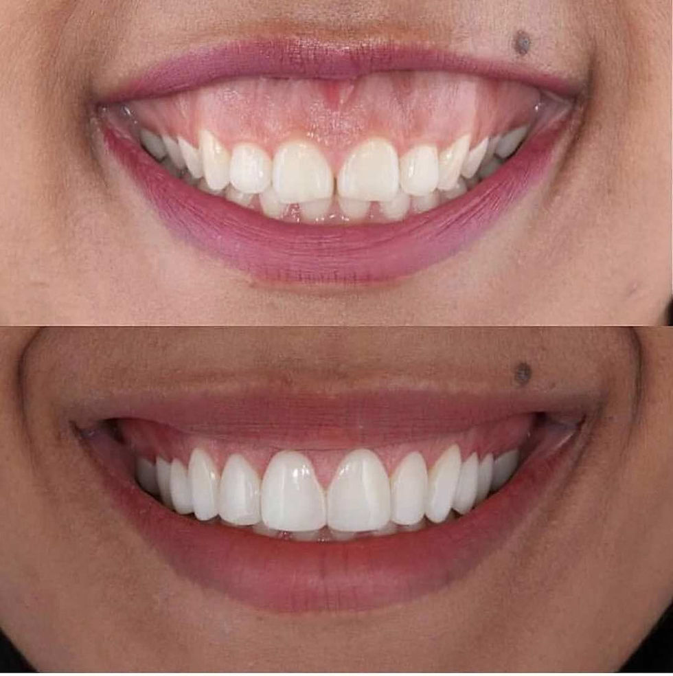 sorriso_gengivale.jpg