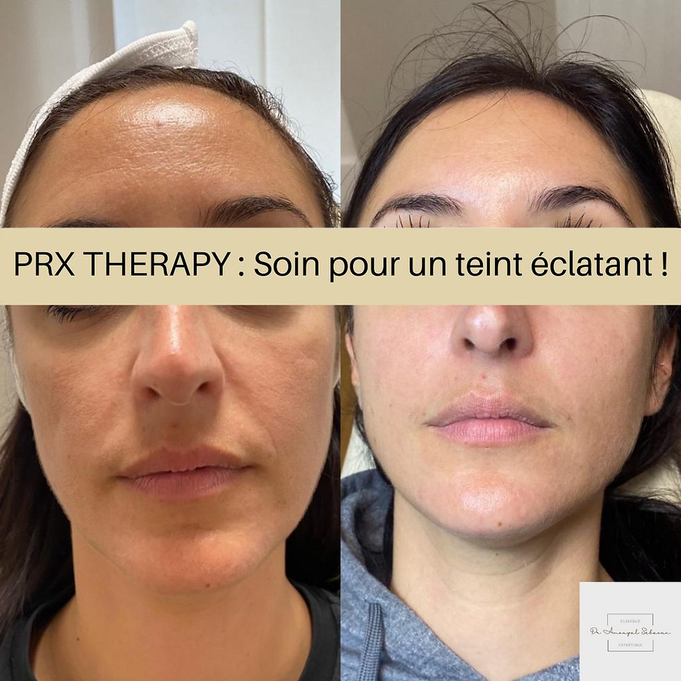 Le PRX THERAPIE : Soin pour un teint éclatant