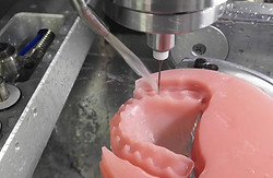 digital dentures