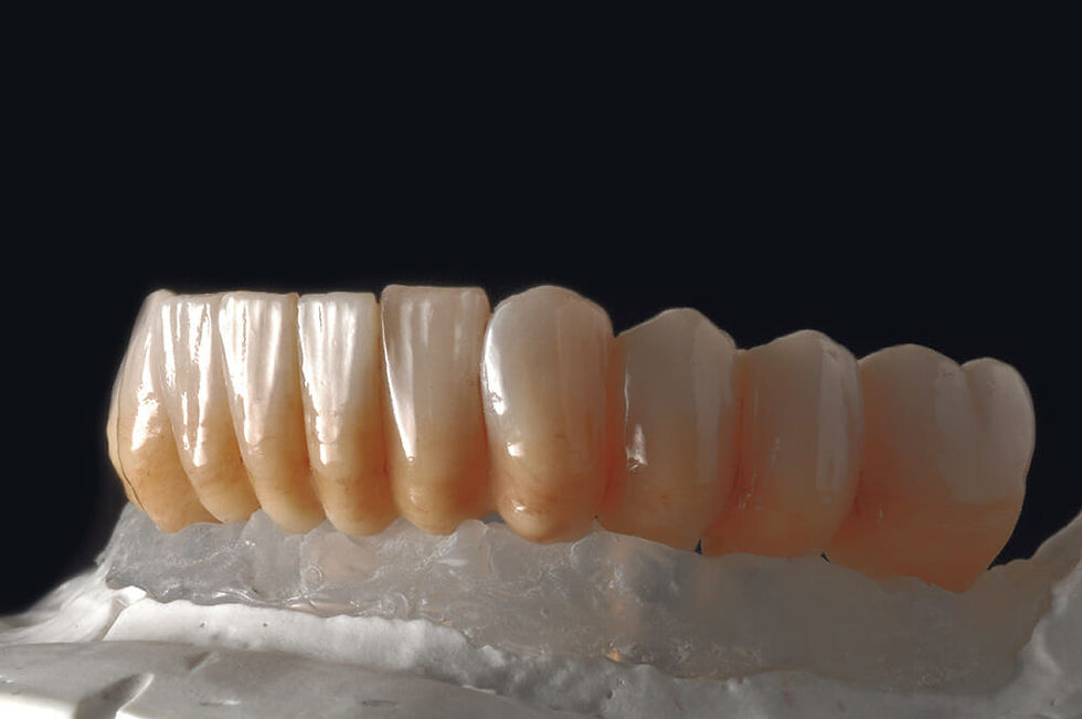 zirconia bridge