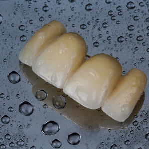 detalhe de dentes para aplicação sobre implante em fibonacci odontologia