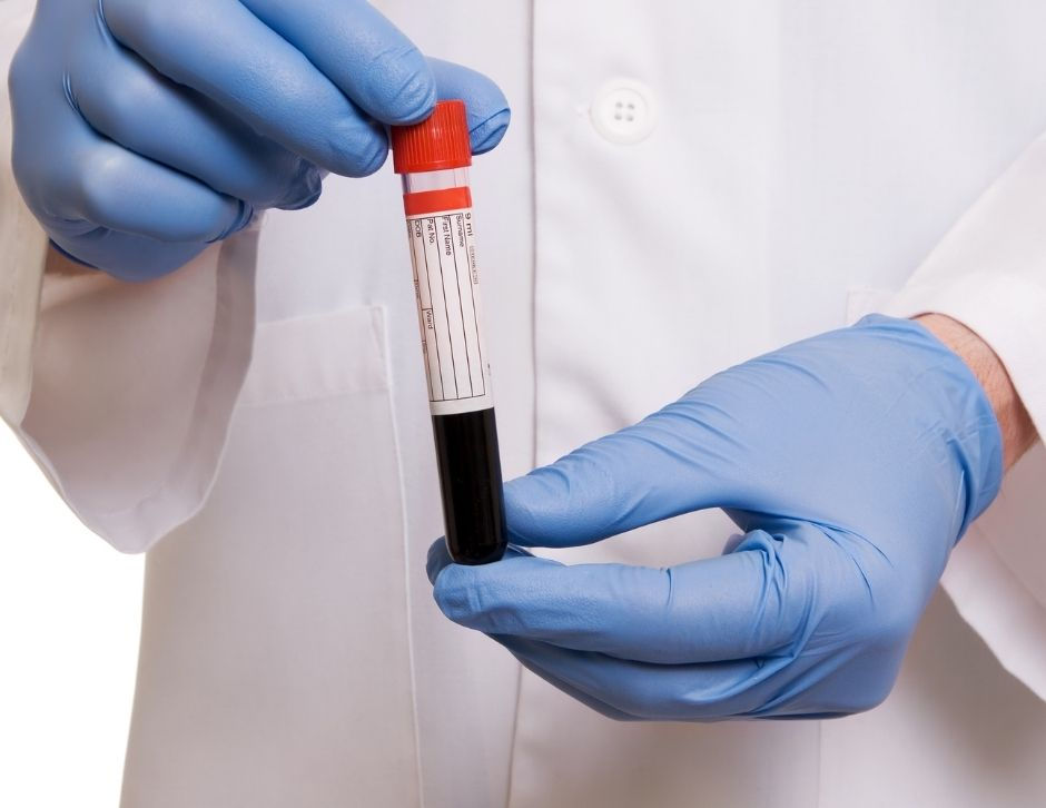 How Long Does It Take to Get DUI Blood Test Results?