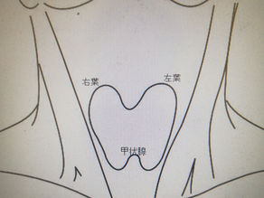 甲状腺とは