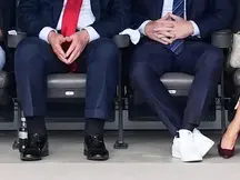 Trump's Swollen Ankles
