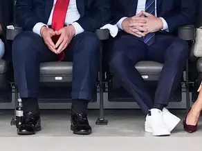 Trump's Swollen Ankles