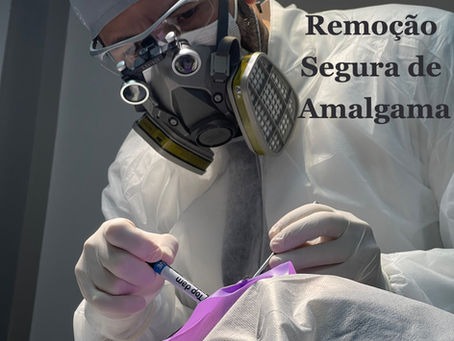 Obturação de Amalgama e MERCÚRIO, ATENÇÃO!!