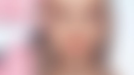 Complete Thread Lift Comparison Guide for Anyone Considering a Non-Surgical Lift in 2026