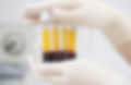 Gretchen - PRP hands test tubes.jpeg