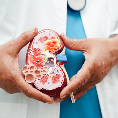 kidney specialist